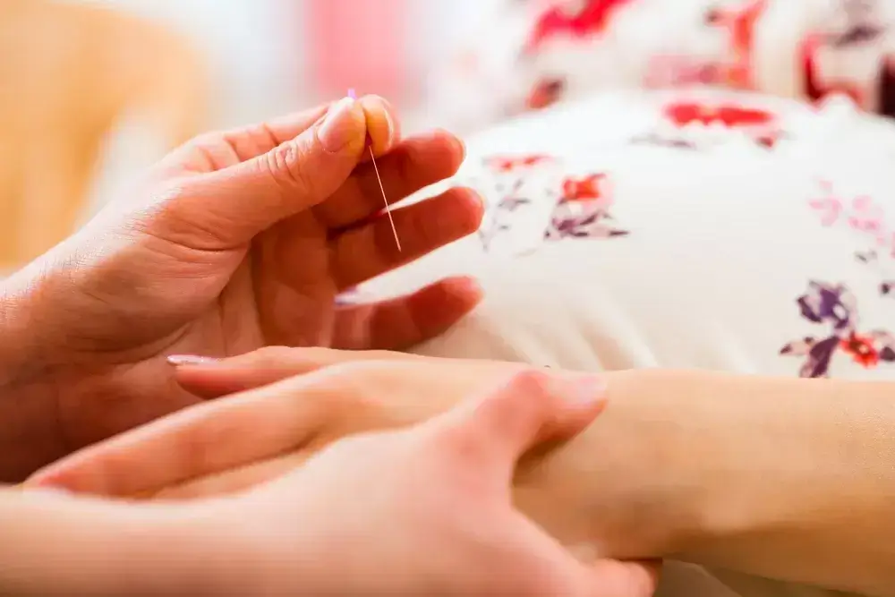 Mississauga Acupuncture for Pregnancy